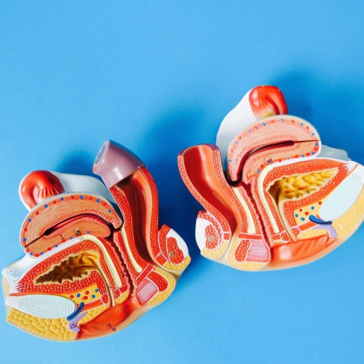 Being Athletic In Perimenopause and Beyond 1 pelvic floor model